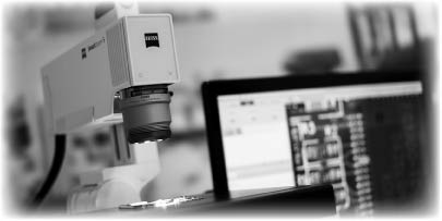 smartzoom_5_product_monitor1 smartzoom_5_product_monitor1